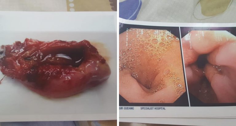 Tak Perlu Risikokan Diri Ambil Ubat ‘Pengetat’ Atau Jamu Timbang Kilo. Jaga Diri Sebelum Kahwin!