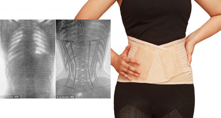 Korset Tak Bakar Lemak Sebaliknya Sekadar Ilusi Kurus