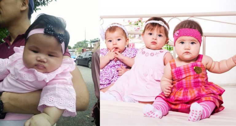 Ibu Jangan Obses, Bahaya Pakaikan Aksesori Di Kepala Bayi Masa Raya