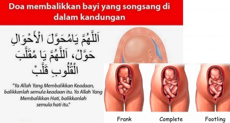 Digalakkan Untuk Sujud Lama Dan Baca Surah Al-Insyirah Sebanyak 10 Kali Jika Kedudukan Bayi Songsang
